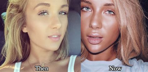 niykee heaton boobs|Niykee Heaton: Before And After Transformation